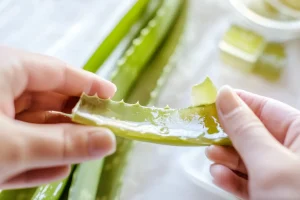 Aloe Vera Verbrennungen